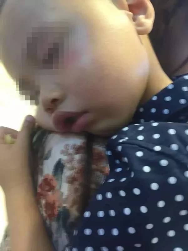 2歲娃被陌生女子毆打后腦勺著地鼻子出血 看了監(jiān)控讓人后怕  監(jiān)控新聞  第1張